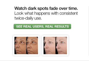 Watch dark spots fade over time. Look what happens with consistent twice-daily use. SEE REAL USERS, REAL RESULTS