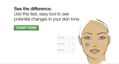 See the difference. Use this fast, easy tool to see potential changes in your skin tone.  START NOW.